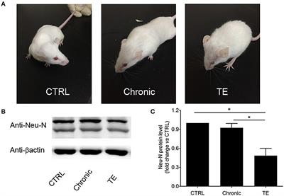 Corrigendum: The Neurotropic Parasite Toxoplasma gondii Induces Astrocyte Polarization Through NFκB Pathway